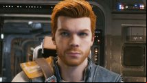Star Wars Jedi Survivor beginner tips and tricks