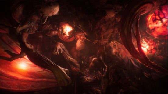 An amalgamation of limbs and bodies trapped in a film of flesh and skin, in a surreal tableau that doesn't resemble reality.
