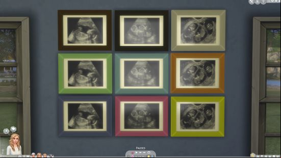 Best Sims 4 mods: a series of framed pictures on a wall, each containing an ultrasound image.